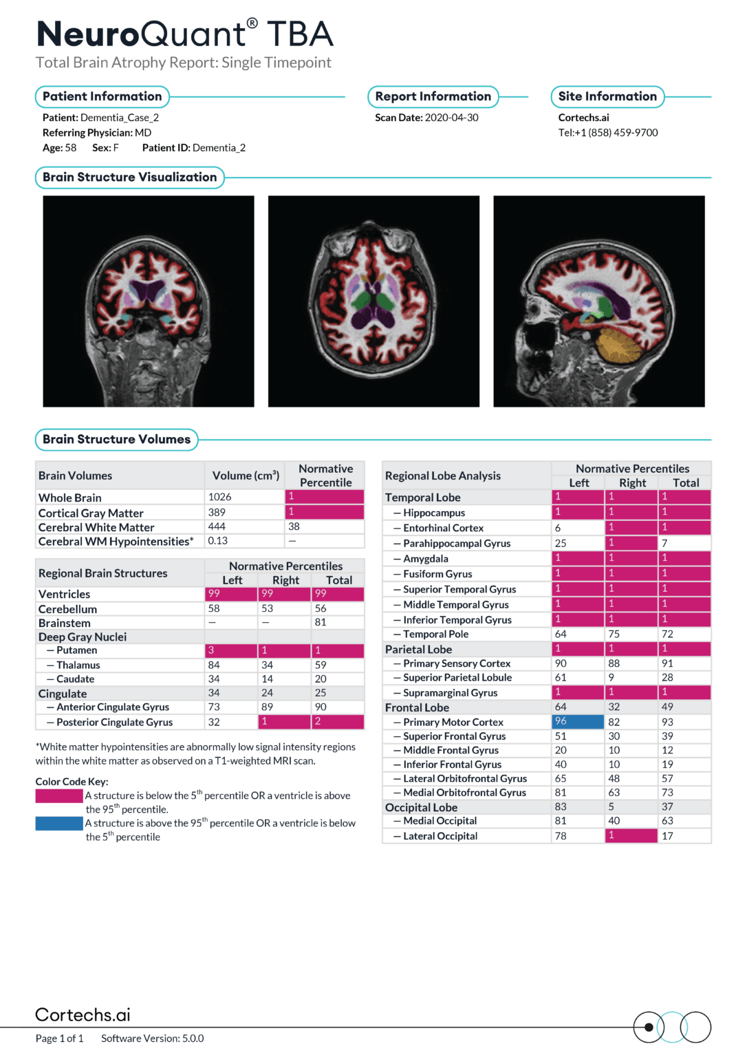 Neurowquant Brain MRI with NeuroQuant® Procedure | Rezilir Health
