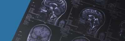 impact of creatine on the brain blog