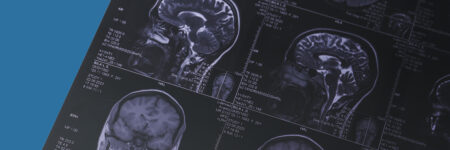 impact of creatine on the brain blog