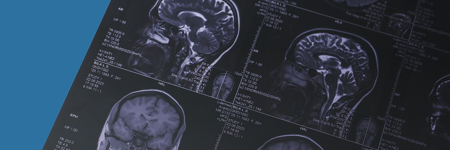 impact of creatine on the brain blog