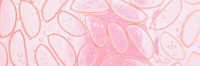 cross section of plant cells colored pink
