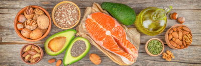 fat heavy food spread on table