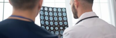 doctors examining brain scan
