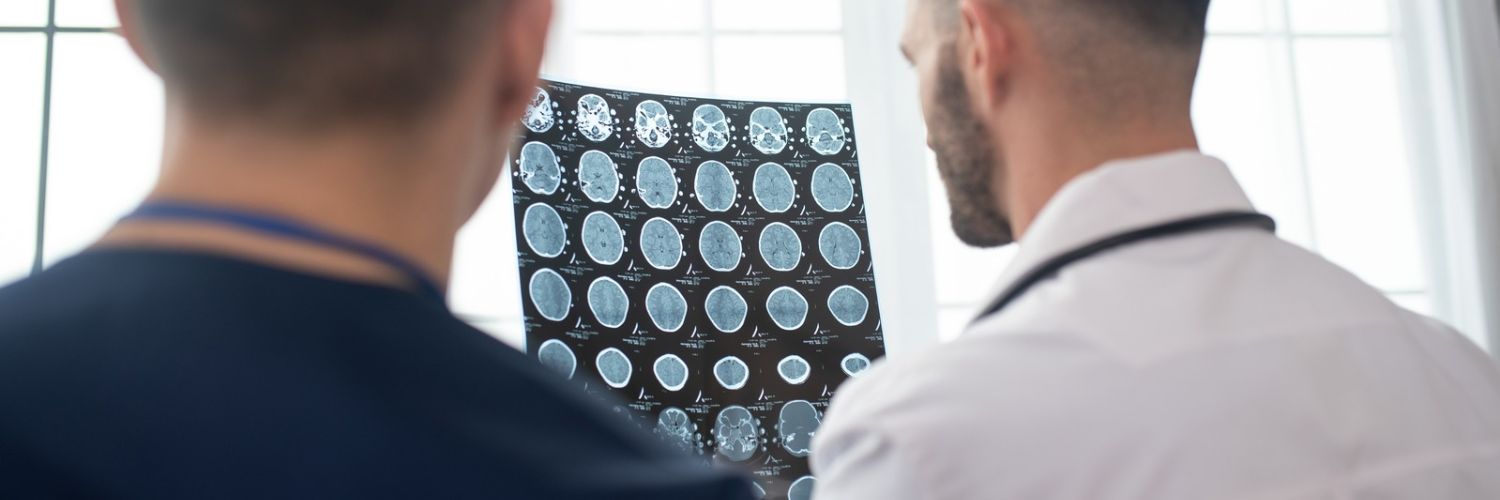 doctors examining brain scan